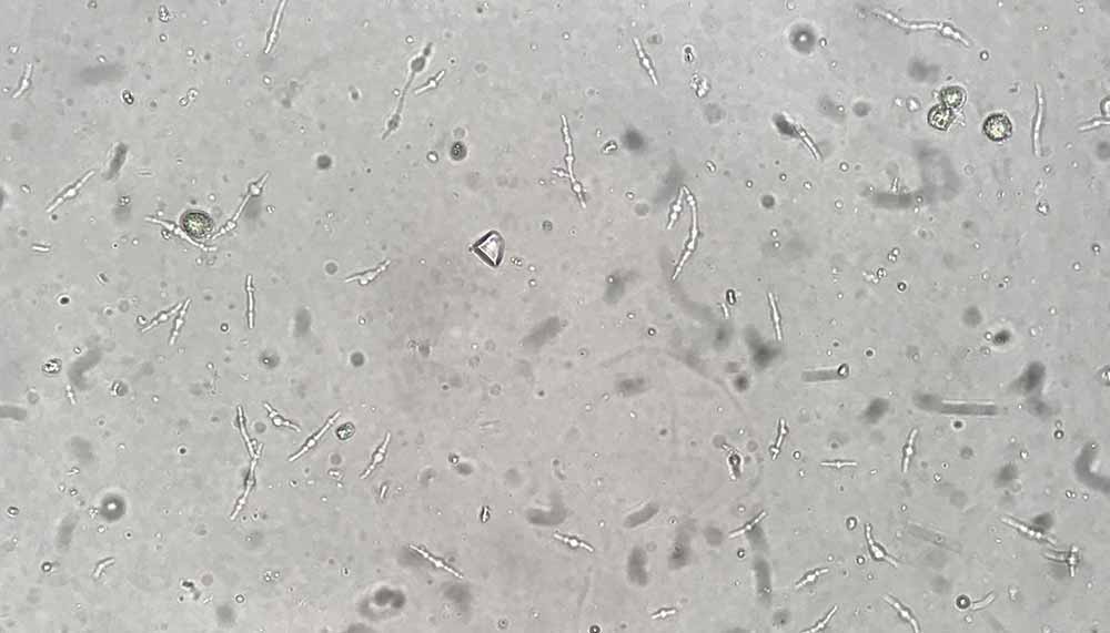 bacteria-urine